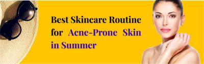 Best Summer Skincare Routine for Acne-Prone Skin